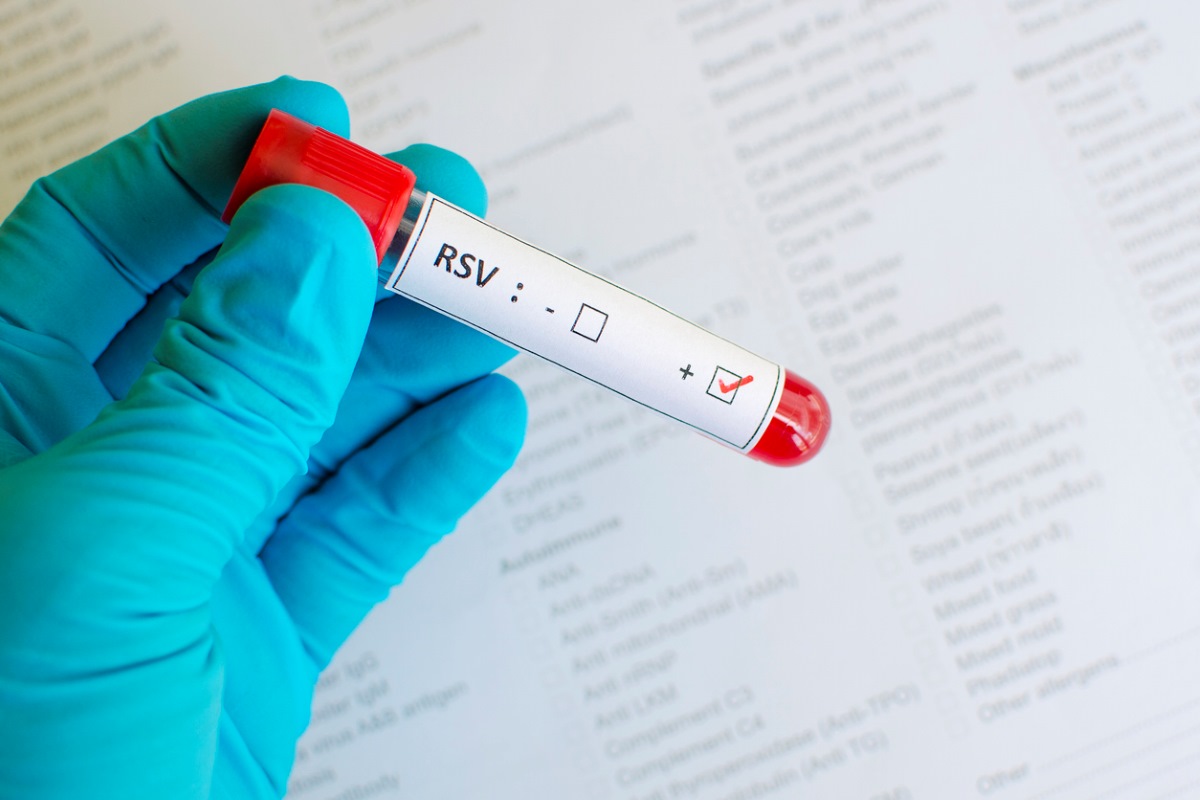 Rapid RSV Testing: Fast Answers When Your Child Needs Them Most
