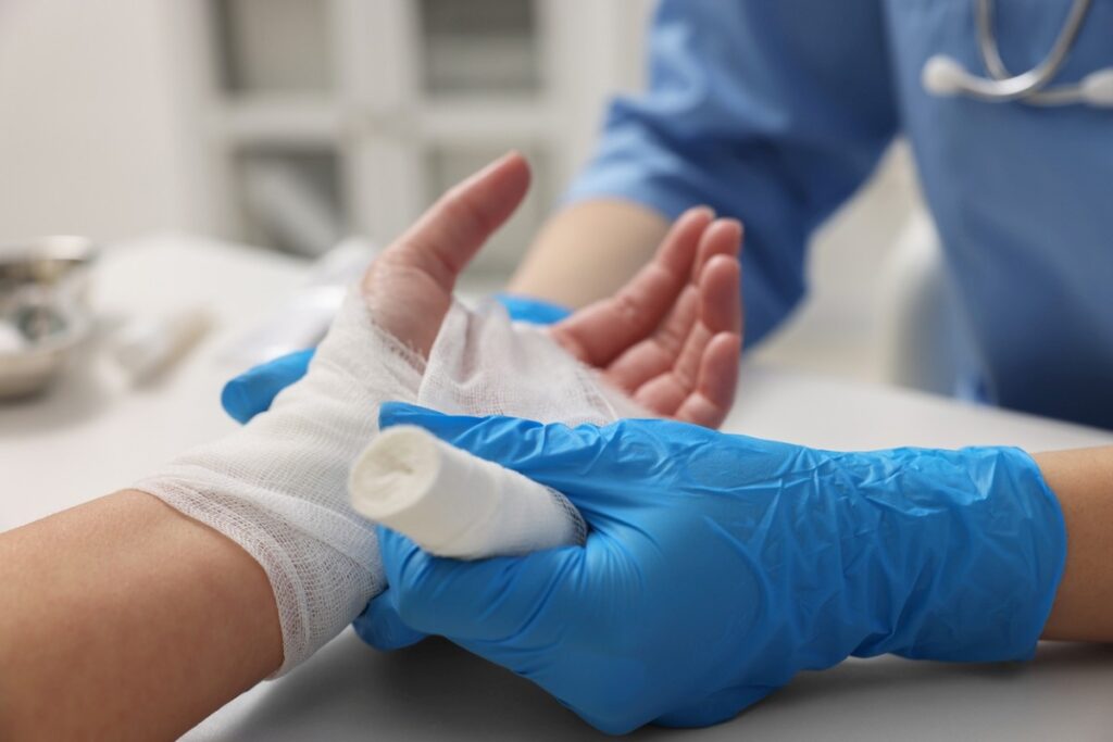 First Aid for Minor Burns: When It’s Time for Professional Care