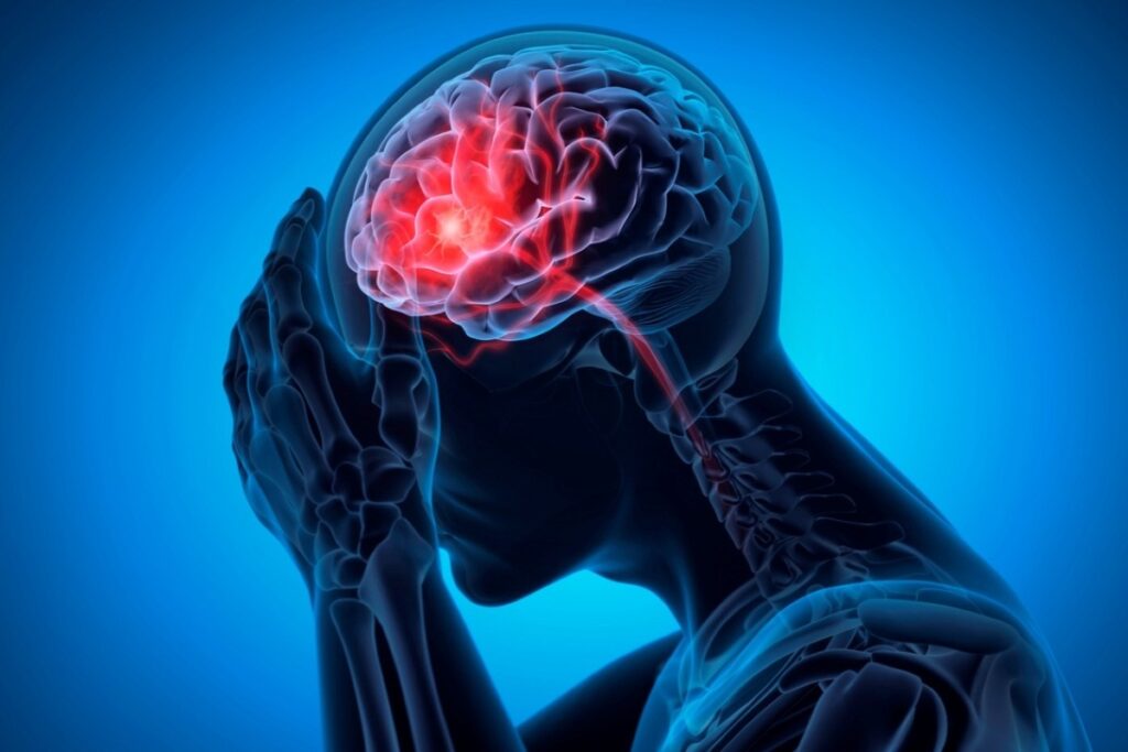 When To Go To Urgent Care For A Headache Or Migraine In Tampa