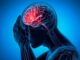 When To Go To Urgent Care For A Headache Or Migraine In Tampa