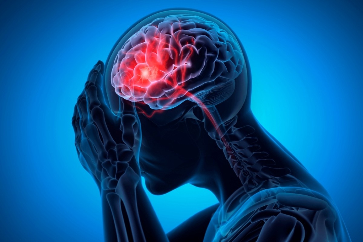 When To Go To Urgent Care For A Headache Or Migraine In Tampa